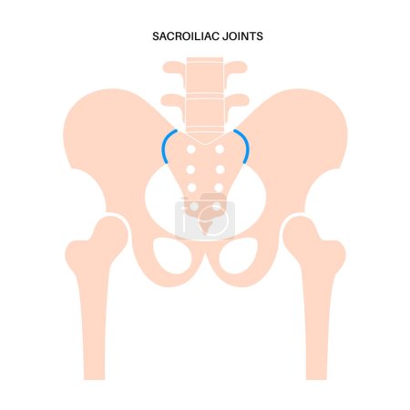 Illustration for Healthy sacroiliac joints medical poster. Lower spine and pelvis connection. Sacrum and ilium cartilages. Backbone, legs and hip anatomy, skeletal flat vector illustration for clinic or education - Royalty Free Image