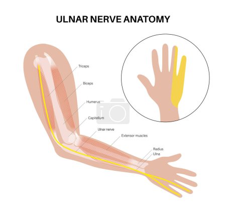 Illustration for Ulnar nerve anatomical poster. Single nerve in the peripheral nervous system. Abnormal sensations in the little finger, elbow and wrist region medical flat vector illustration for clinic or education. - Royalty Free Image