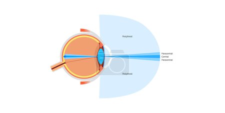 Illustration for Peripheral vision infographic diagram. Indirect vision, capturing the human eye expanded field of view beyond central focus, see in low light conditions. Tunnel vision problems. Eyeball medical poster - Royalty Free Image