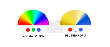 Illustration for Deuteranopia and normal vision, color blindness infographic. Human vision deficiency concept. Difference between colors, brightness and intensity of shades flat vector illustration - Royalty Free Image