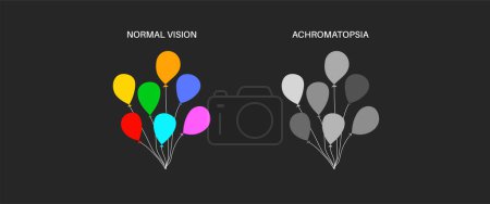 Illustration for Achromatopsia and normal vision, color blindness infographic. Human vision deficiency concept. Difference between colors, brightness and intensity of shades. Eye abnormality flat vector illustration - Royalty Free Image