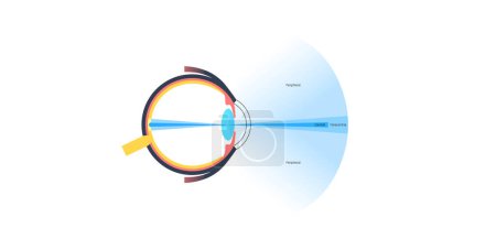 Illustration for Peripheral vision infographic diagram. Indirect vision, capturing the human eye expanded field of view beyond central focus, see in low light conditions. Tunnel vision problems. Eyeball medical poster - Royalty Free Image