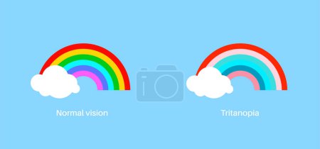 Illustration for Color blindness infographic. Human vision deficiency concept. Difference between colors, brightness and intensity of shades. Tritanopia vision, eye abnormality flat vector illustration - Royalty Free Image