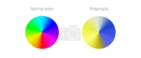 Ilustración de Infografía de daltonismo. Concepto de deficiencia de visión humana. Diferencia entre colores, brillo e intensidad de los tonos. Tritanopía visión, anormalidad ocular ilustración vectorial plana - Imagen libre de derechos