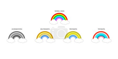 Infografía de daltonismo. Concepto de deficiencia visual. Diferencia entre colores. Deuteranomalía deuteranopía y protanomalía. Protanopía, tritanopía y tritanomalía. Acromatopsia vector ilustración