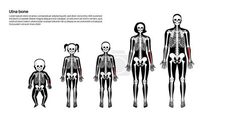 Ulna poster anatomique osseux. Avant-bras dans le schéma squelettique humain. Squelette en silhouette mâle, femelle, bébé, enfant et adulte. Os, cartilages et articulations dans l'illustration vectorielle médicale de rayons X du corps