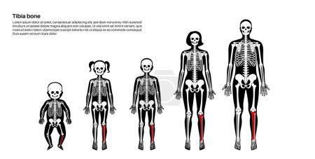 Ilustración de Anatomía ósea de Tibia. Tibia en el diagrama del sistema esquelético humano. Cartel de la espinilla, Esqueleto en siluetas masculinas, femeninas, de bebé, de niño y de adulto. Cartílago y articulaciones en la ilustración del vector plano de rayos X del cuerpo - Imagen libre de derechos