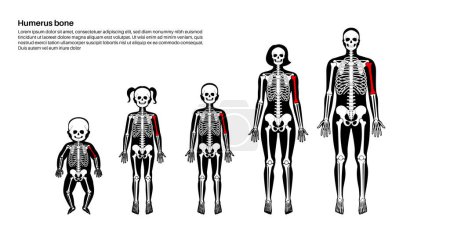 Humerus-Knochen-Anatomie. Unterarm im Diagramm des menschlichen Skelettsystems. Skelett in männlichen, weiblichen, Baby-, Kinder- und Erwachsenensilhouetten. Knochen, Knorpel und Gelenke im Körper Röntgen Medizinische Plakatvektorillustration