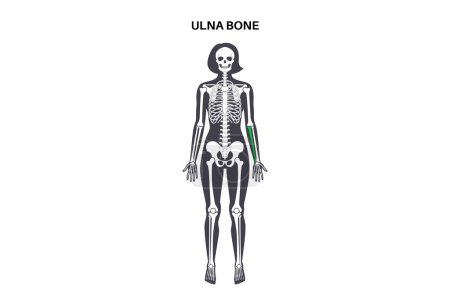 Illustration for Ulna bone anatomy. Forearm in human skeletal system diagram. Skeleton in female silhouette. Bones, cartilage and joints in woman body, x ray shoulders, elbows, pelvis medical vector illustration. - Royalty Free Image