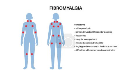 Fibromyalgia in the female body. Chronic widespread pain in joints muscles, fatigue and cognitive symptoms. Musculoskeletal disease. Red points in woman silhouette medical flat vector illustration.