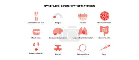 Systemic lupus erythematosus medical poster. Butterfly or malar rash on a female face. Autoimmune disease concept. Inflammation and skin tissue damage, pain in the internal organs vector illustration