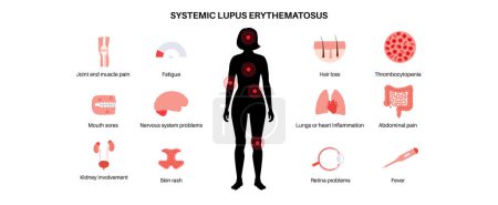 Systemic lupus erythematosus medical poster. Butterfly or malar rash on a female face. Autoimmune disease concept. Inflammation and skin tissue damage, pain in the internal organs vector illustration