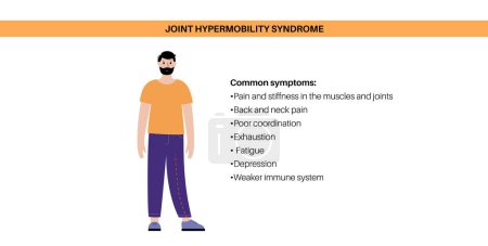 Illustration for Joint hypermobility syndrome or hypermobility spectrum disorder. Abnormal large range of movement in human legs. Elastic, and stretchy skin and limbs in the human body medical flat vector illustration - Royalty Free Image