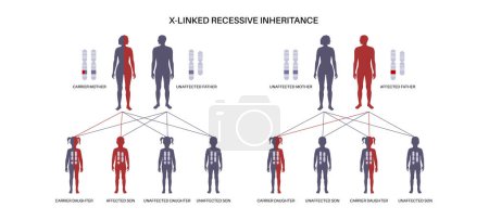 Ilustración de X linked recessive inheritance pattern. Child inherits one copy of a mutated gene from each parent. Genetic disease or disorder. Affected, carriers or healthy X and Y chromosomes vector illustration. - Imagen libre de derechos