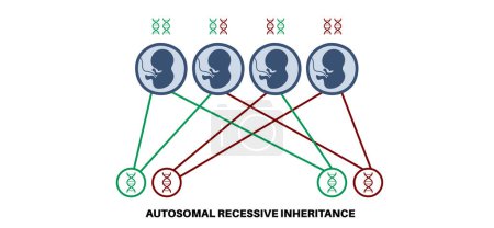 Autosomal recessive inheritance pattern. Child inherits one copy of a mutated gene from each parent. Genetic disease or disorder. Affected, carriers or healthy X and Y chromosomes vector illustration.