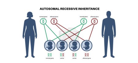 Illustration for Autosomal recessive inheritance pattern. Child inherits one copy of a mutated gene from each parent. Genetic disease or disorder. Affected, carriers or healthy X and Y chromosomes vector illustration. - Royalty Free Image