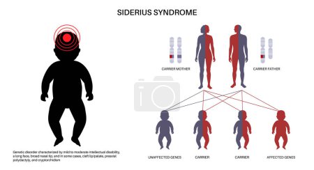 Siderius syndrome poster. X linked intellectual disability. Delayed development of motor skills. Child inherits one copy of a mutated gene from each parent. Affected, carriers or healthy chromosomes