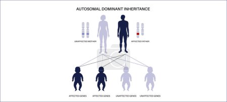 X vinculado patrón de herencia dominante. El niño hereda una copia de un gen mutado de cada padre. Enfermedad o trastorno genético. Afectados, portadores o cromosomas X e Y sanos ilustración vectorial.