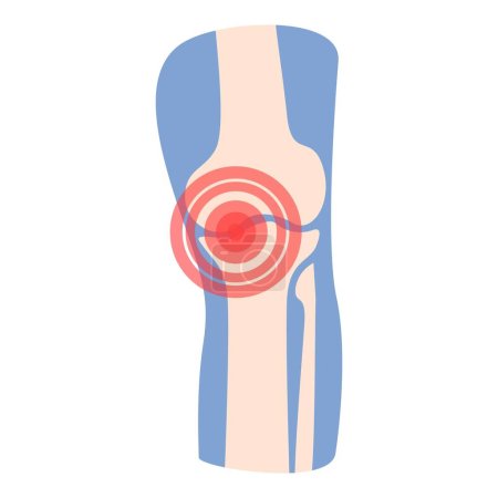 Patient jambe icône dessin animé vecteur. Arthrite articulaire. Traitement de la douleur