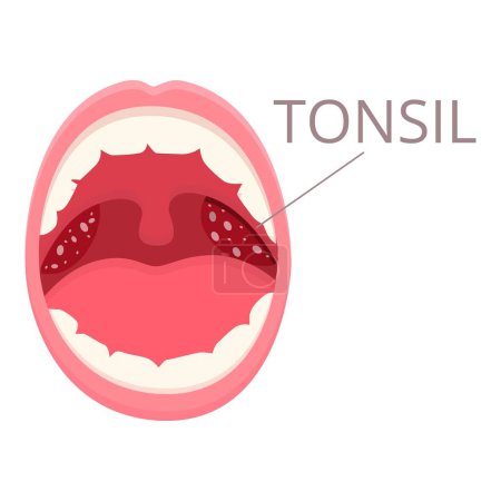 Illustration for Mouth tonsillitis icon cartoon vector. Bacterial hygiene. Cancer medical - Royalty Free Image