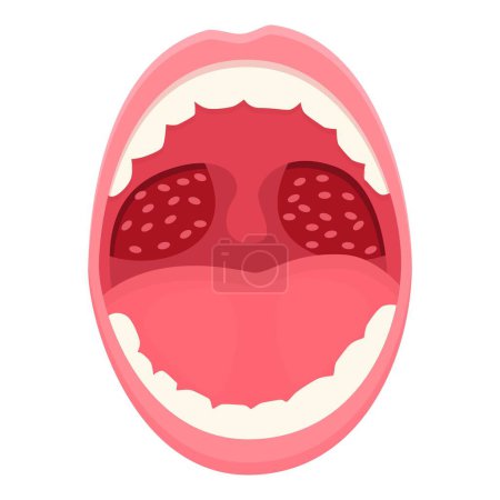Ilustración de Vector de dibujos animados icono infección de la boca. Inflamación de higiene. Cáncer médico - Imagen libre de derechos