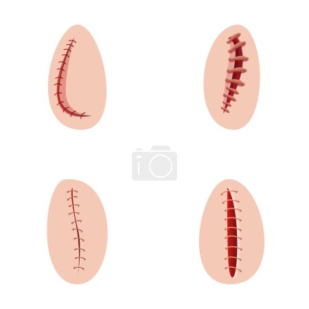 Illustration for Operating suture icons set cartoon vector. Various type of surgical suture. Surgery, medicine concept - Royalty Free Image