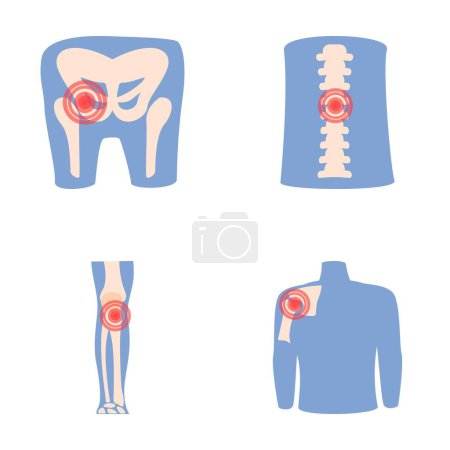 Rheumatism icons set cartoon vector. Human joint with pain ring. Rheumatology, medicine
