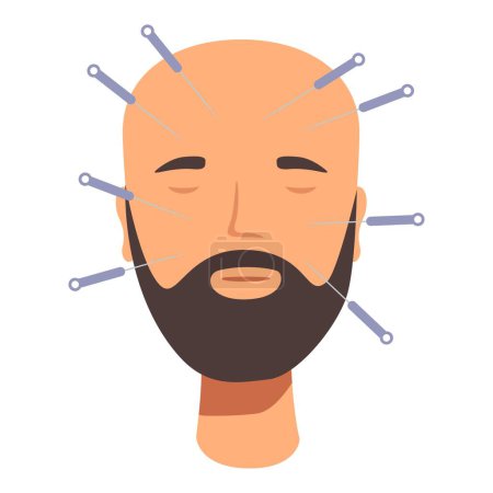 Ilustración del hombre calvo que recibe terapia de acupuntura con agujas en la cabeza para aliviar el dolor y relajarse. Un concepto vectorial para la medicina alternativa y la salud holística