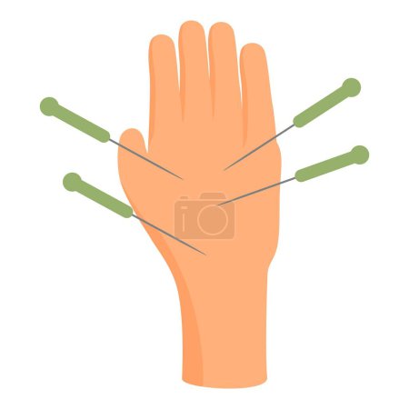 Vector illustration of acupuncture hand model for educational, therapeutic, and holistic alternative medicine, featuring meridian points and traditional chinese therapy