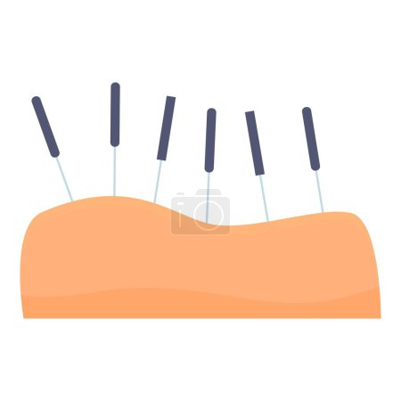 Illustration of acupuncture needles placement for therapeutic alternative medicine, traditional chinese holistic wellness care, and pain relief, in a clean, simple, and sterile vector concept