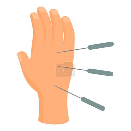 Detailed acupuncture hand model vector illustration for educational clinical practice and therapeutic procedure in alternative chinese medicine therapy
