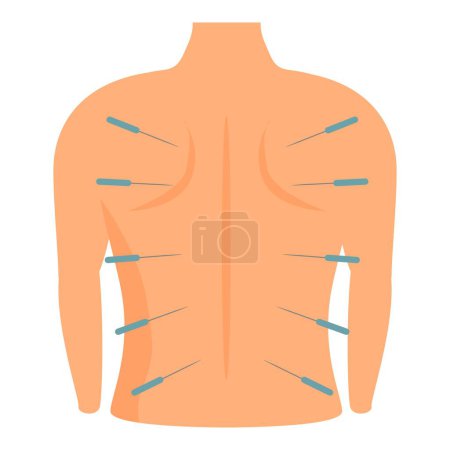 Holistic acupuncture therapy illustration for alternative back pain relief with traditional chinese treatment and therapeutic acupressure