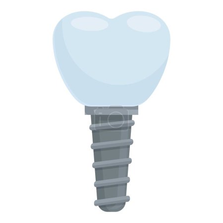 Illustration détaillée de l'implant dentaire pour le remplacement prothétique des dents en dentisterie moderne, avec conception graphique vectorielle et anatomie 3D de précision