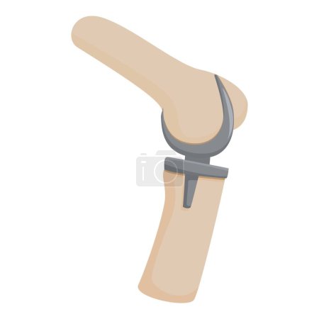 Vector illustration of a modern prosthetic knee joint, isolated on a white background