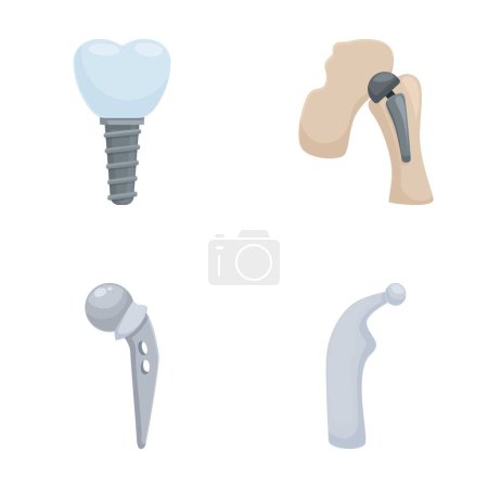 Illustration vectorielle de différents implants médicaux pour la dentisterie et la chirurgie orthopédique