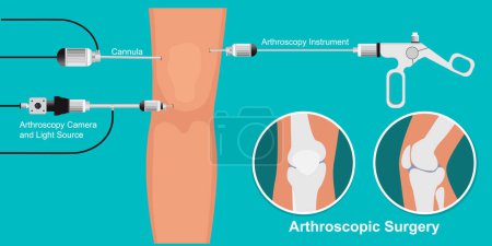 Arthroskopie medizinische Behandlung Chirurgie.
