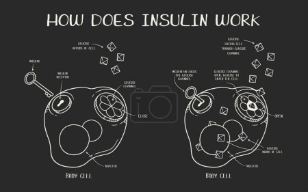 Handgezeichnete Vektorillustration erklärt, wie Insulin auf schwarzem Hintergrund wirkt