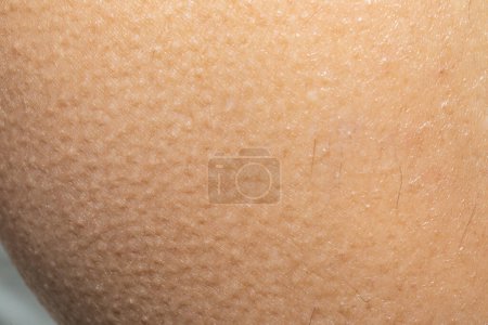 Foto de Macro de piel de mujer con piel de gallina, primer plano de pelo puntiagudo, concepto de defensa del frío - Imagen libre de derechos