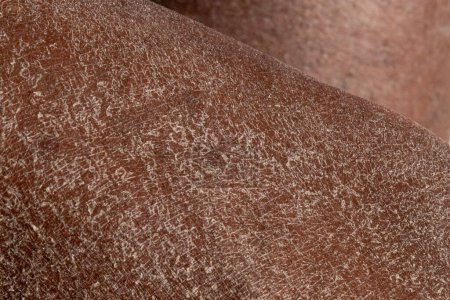 Foto de Macro detalle de la piel seca de las piernas de una mujer africana. Enfoque selectivo de la piel deshidratada. - Imagen libre de derechos