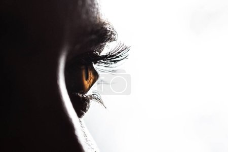 Photo for Macro of a brown woman eye suffering from keratoconus. A cone-shaped deformation of the cornea isolated on white background - Royalty Free Image