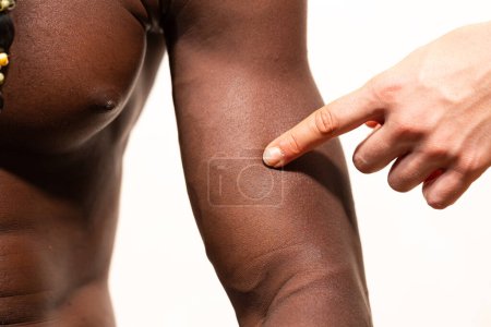 ein Finger zeigt auf einen bestimmten Bereich am Arm, der den Ort einer vermuteten Muskelzerrung anzeigt