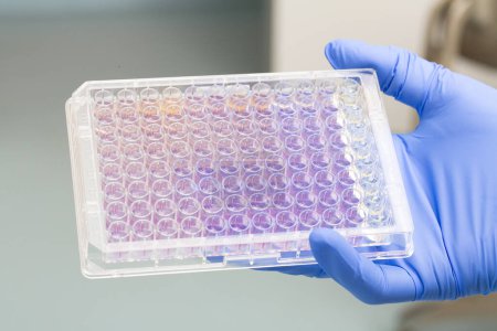 Gloved hand of a laboratory technician holding a microtiter plate filled with color gradient samples, illustrating the process of medical or biochemical analysis