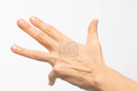 Detailed close-up of a hand with visible signs of joint inflammation, indicative of arthritis, positioned against a clean white background for clear visibility