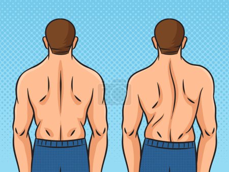 Photo for Man back with scoliosis pinup pop art retro raster illustration. Comic book style imitation. - Royalty Free Image