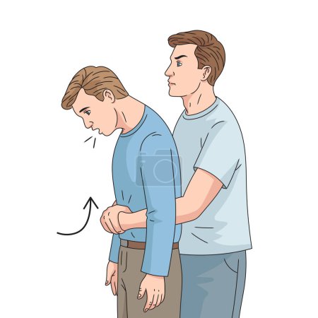 Abdominal thrusts first-aid procedure Heimlich maneuver diagram hand drawn schematic raster illustration. Medical science educational illustration