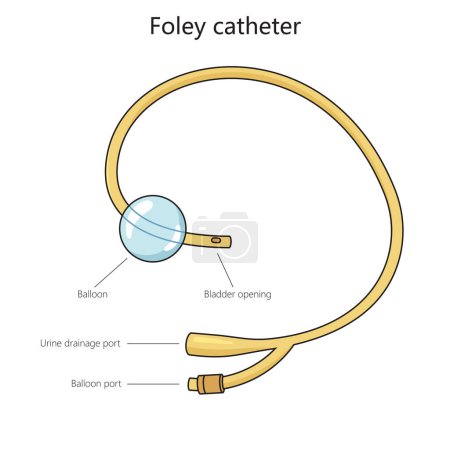 Photo for Urinary foley catheter structure diagram hand drawn schematic raster illustration. Medical science educational illustration - Royalty Free Image