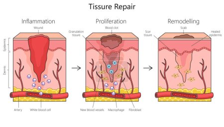 Tissue repair structure diagram hand drawn schematic raster illustration. Medical science educational illustration