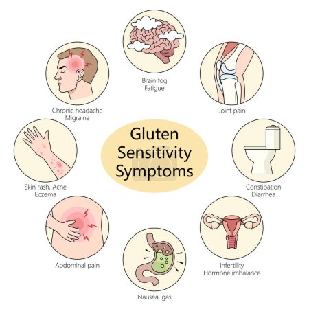 gluten sensitivity symptoms including migraines, joint pain, and skin rashes diagram hand drawn schematic raster illustration. Medical science educational illustration