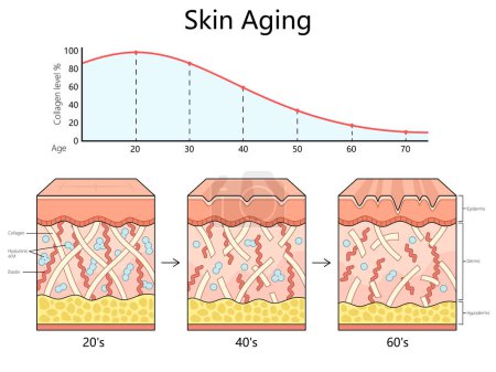 skin aging process from the 20s to the 60s, showing the decrease in collagen, elastin, and hyaluronic acid diagram hand drawn schematic raster illustration. Medical science educational illustration