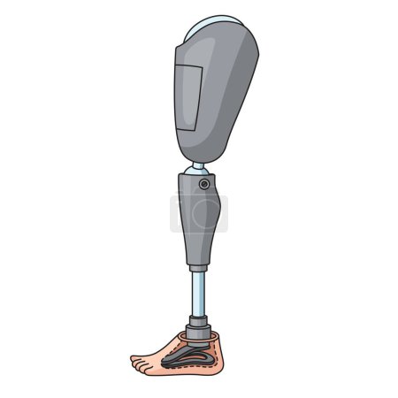 Téléchargez les illustrations : Schéma de la prothèse de jambe humaine illustration vectorielle schématique. Illustration pédagogique en sciences médicales - en licence libre de droit